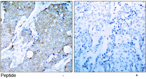 Rabbit Anti VEGFR2 (Ab-1214) (polyclonal)Immunohistochemical analysis Rabbit Anti VEGFR2 (Ab-1214) (polyclonal) Immunohistochemical analysis