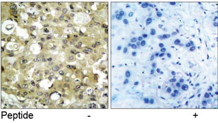 Rabbit Anti-VEGFR2 (Ab-951) Polyclonal Antibody IHC Rabbit Anti-VEGFR2 (Ab-951) Polyclonal Antibody IHC