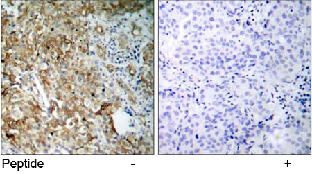 Rabbit Anti-IGF-1R (Ab-1161) Polyclonal Antibody IHC Rabbit Anti-IGF-1R (Ab-1161) Polyclonal Antibody IHC