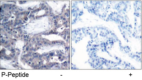 Rabbit Anti MEK2 (Phospho-Thr394) (polyclonal) Immunohistochemical analysis Rabbit Anti MEK2 (Phospho-Thr394) (polyclonal) Immunohistochemical analysis