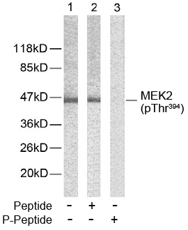 Rabbit Anti MEK2 (Phospho-Thr394) (polyclonal) Western Blot analysis Rabbit Anti MEK2 (Phospho-Thr394) (polyclonal) Western Blot analysis