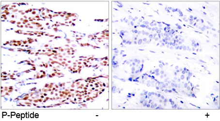 Rabbit Anti JunB (Phospho-Ser79) (polyclonal) Immunohistochemical analysis