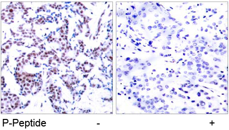 Rabbit Anti JunB (Phospho-Ser259) (polyclonal) Immunohistochemical analysis Rabbit Anti JunB (Phospho-Ser259) (polyclonal) Immunohistochemical analysis