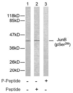 Rabbit Anti JunB (Phospho-Ser259) (polyclonal) Western Blot analysis Rabbit Anti JunB (Phospho-Ser259) (polyclonal) Western Blot analysis