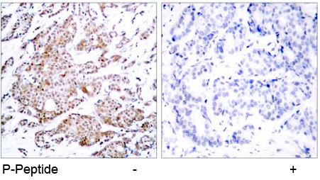 Rabbit Anti Myc (Phospho-Thr58) (polyclonal)Immunohistochemical analysis