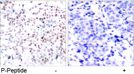 Rabbit Anti Myc (Phospho-Thr358) (polyclonal) Immunohistochemical analysis Rabbit Anti Myc (Phospho-Thr358) (polyclonal) Immunohistochemical analysis