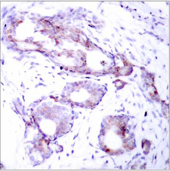 Rabbit Anti Myc (Phospho-Ser373) (polyclonal) Immunohistochemical analysis Rabbit Anti Myc (Phospho-Ser373) (polyclonal) Immunohistochemical analysis