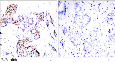 Rabbit Anti Elk-1 (Phospho-Ser389) (polyclonal) Immunohistochemical analysis Rabbit Anti Elk-1 (Phospho-Ser389) (polyclonal) Immunohistochemical analysis