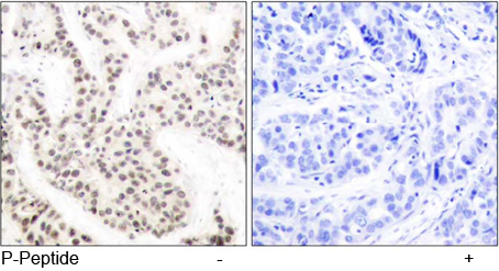 Rabbit Anti Elk-1 (Phospho-Thr417) (polyclonal) Immunohistochemical analysis Rabbit Anti Elk-1 (Phospho-Thr417) (polyclonal) Immunohistochemical analysis