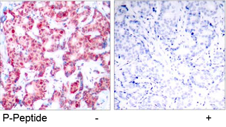Rabbit Anti GATA-1 (Phospho-Ser142) (polyclonal) Immunohistochemical analysis