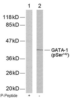 Rabbit Anti GATA-1 (Phospho-Ser142) (polyclonal) Western Blot analysis