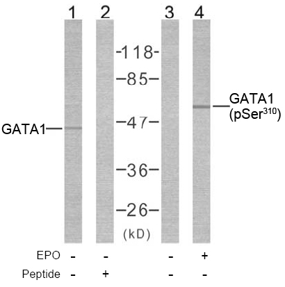 Rabbit Anti GATA1 (Phospho-Ser310) (polyclonal) Western Blot analysis Rabbit Anti GATA1 (Phospho-Ser310) (polyclonal) Western Blot analysis
