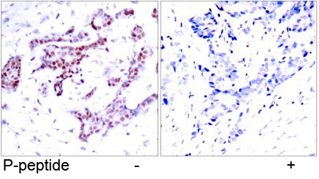 Rabbit Anti STAT1 (Phospho-Tyr701) (polyclonal) Immunohistochemical analysis