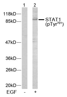 Rabbit Anti STAT1 (Phospho-Tyr701) (polyclonal) Western Blot analysis