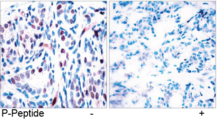 Rabbit Anti-STAT3 (Phospho-Tyr705) Polyclonal Antibody IHC Rabbit Anti-STAT3 (Phospho-Tyr705) Polyclonal Antibody IHC