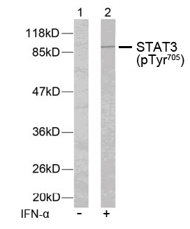 Rabbit Anti STAT3 (Phospho-Tyr705) (polyclonal) Western Blot analysis Rabbit Anti STAT3 (Phospho-Tyr705) (polyclonal) Western Blot analysis