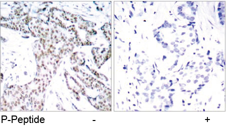 Rabbit Anti STAT3 (Phospho-Ser727) (polyclonal) Immunohistochemical analysis Rabbit Anti STAT3 (Phospho-Ser727) (polyclonal) Immunohistochemical analysis