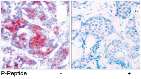 Rabbit Anti STAT4 (Phospho-Tyr693) (polyclonal) Immunohistochemical analysis