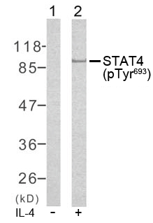 Rabbit Anti STAT4 (Phospho-Tyr693) (polyclonal) Western Blot analysis