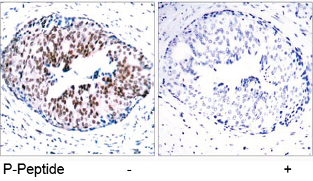 Rabbit Anti STAT5A (Phospho-Ser780) (polyclonal) Immunohistochemical analysis Rabbit Anti STAT5A (Phospho-Ser780) (polyclonal) Immunohistochemical analysis