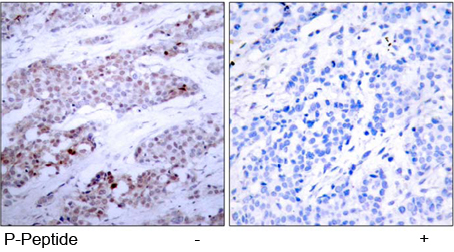 Rabbit Anti ATF4 (Phospho-Ser245) (polyclonal) Immunohistochemical analysis