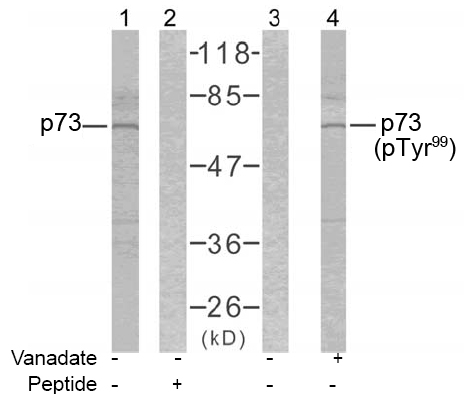 Rabbit Anti-p73 (Phospho-Tyr99) Polyclonal Antibody Western Blot analysis Rabbit Anti-p73 (Phospho-Tyr99) Polyclonal Antibody Western Blot analysis