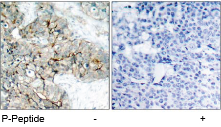 Rabbit Anti-Integrin β3 (Phospho-Tyr773) Polyclonal Antibody Immunohistochemical analysis