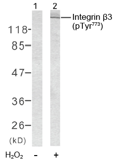 Rabbit Anti-Integrin β3 (Phospho-Tyr773) Polyclonal Antibody Western Blot analysis