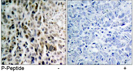 Rabbit Anti-Chk2 (Phospho-Thr68) Polyclonal Antibody Immunohistochemical analysis