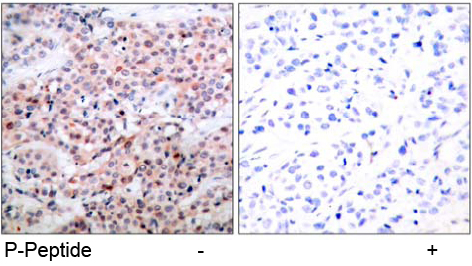 Rabbit Anti BCL-2 (Phospho-Thr56) (polyclonal) Immunohistochemical analysis Rabbit Anti BCL-2 (Phospho-Thr56) (polyclonal) Immunohistochemical analysis