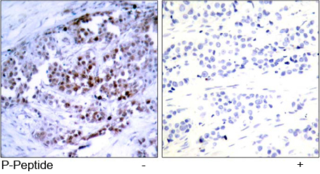 Rabbit Anti BCL-2 (Phospho-Ser70) (polyclonal) Immunohistochemical analysis Rabbit Anti BCL-2 (Phospho-Ser70) (polyclonal) Immunohistochemical analysis