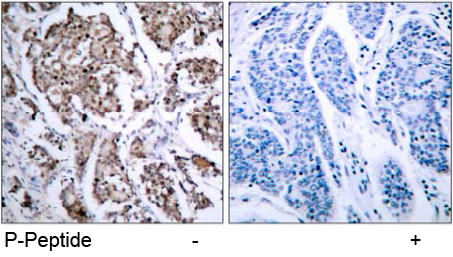 Rabbit Anti BAD (Phospho-Ser155) (polyclonal) Immunohistochemical analysis