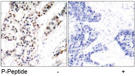 Rabbit Anti Estrogen Receptor-α (Phospho-Ser106) (polyclonal) Immunohistochemical analysis Rabbit Anti Estrogen Receptor-α (Phospho-Ser106) (polyclonal) Immunohistochemical analysis