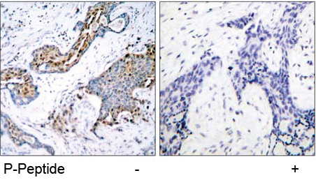 Rabbit Anti Estrogen Receptor-α (Phospho-Ser118) (polyclonal) Immunohistochemical analysis