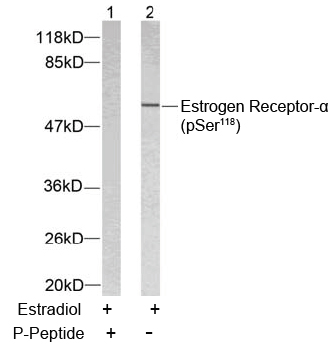 Rabbit Anti Estrogen Receptor-α (Phospho-Ser118) (polyclonal) Western Blot analysis