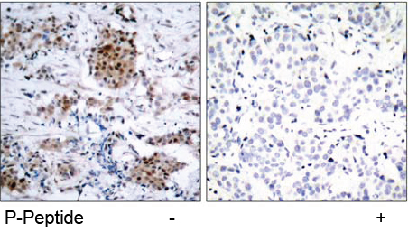 Rabbit Anti Estrogen Receptor-α (Phospho-Ser167) (polyclonal) Immunohistochemical analysis Rabbit Anti Estrogen Receptor-α (Phospho-Ser167) (polyclonal) Immunohistochemical analysis