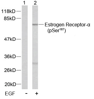 Rabbit Anti Estrogen Receptor-α (Phospho-Ser167) (polyclonal) Western Blot analysis Rabbit Anti Estrogen Receptor-α (Phospho-Ser167) (polyclonal) Western Blot analysis