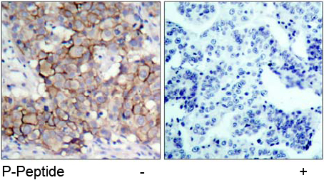 Rabbit Anti HER2 (Phospho-Tyr877) (polyclonal) Immunohistochemical analysis