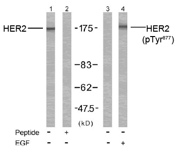 Rabbit Anti HER2 (Phospho-Tyr877) (polyclonal) Western Blot analysis