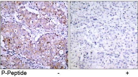 Rabbit Anti-EGFR (Phospho-Ser1070) Polyclonal Antibody IHC Rabbit Anti-EGFR (Phospho-Ser1070) Polyclonal Antibody IHC