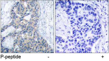 Rabbit Anti Stathmin 1 (Phospho-Ser37) (polyclonal) Immunohistochemical analysis