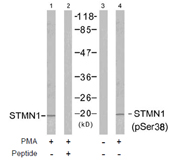 Rabbit Anti Stathmin 1 (Phospho-Ser37) (polyclonal) Western Blot analysis Rabbit Anti Stathmin 1 (Phospho-Ser37) (polyclonal) Western Blot analysis