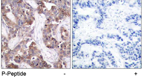 Rabbit Anti Stathmin 1 (Phospho-Ser25) (polyclonal) Immunohistochemical analysis Rabbit Anti Stathmin 1 (Phospho-Ser25) (polyclonal) Immunohistochemical analysis