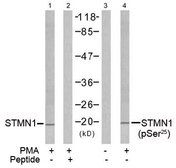 Rabbit Anti Stathmin 1 (Phospho-Ser25) (polyclonal) Western Blot analysis Rabbit Anti Stathmin 1 (Phospho-Ser25) (polyclonal) Western Blot analysis