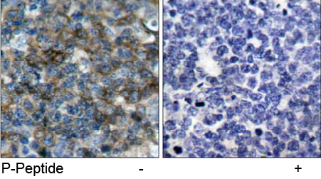Rabbit Anti VASP (Phospho-Ser157) (polyclonal) Immunohistochemical analysis Rabbit Anti VASP (Phospho-Ser157) (polyclonal) Immunohistochemical analysis