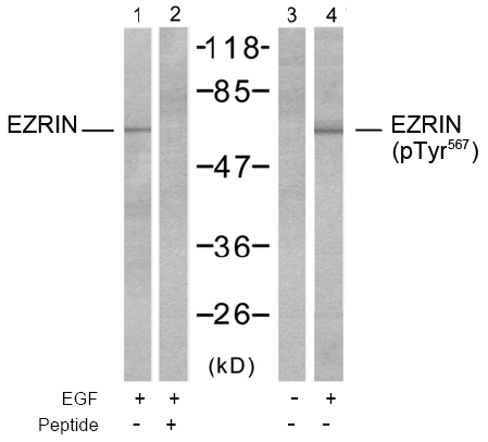 Rabbit Anti Ezrin (Phospho-Thr566) (polyclonal) Western Blot analysis Rabbit Anti Ezrin (Phospho-Thr566) (polyclonal) Western Blot analysis