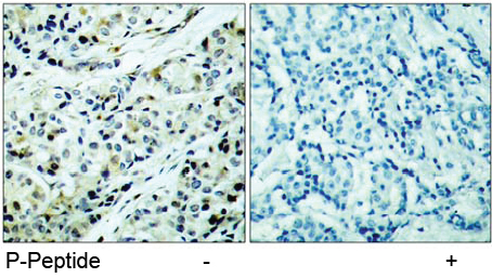 Rabbit Anti HDAC5(Phospho-Ser498) (polyclonal) Immunohistochemical analysis Rabbit Anti HDAC5(Phospho-Ser498) (polyclonal) Immunohistochemical analysis