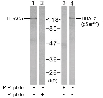 Rabbit Anti HDAC5(Phospho-Ser498) (polyclonal) Western Blot analysis Rabbit Anti HDAC5(Phospho-Ser498) (polyclonal) Western Blot analysis