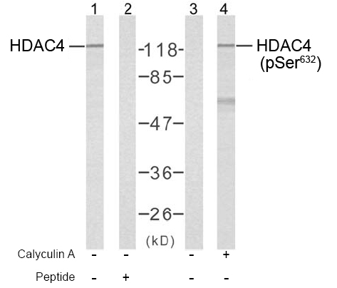 Rabbit Anti HDAC4 (Phospho-Ser632) (polyclonal) Western Blot analysis Rabbit Anti HDAC4 (Phospho-Ser632) (polyclonal) Western Blot analysis