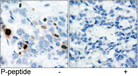 Rabbit Anti Histone H3.1 (Phospho-Ser10) (polyclonal) Immunohistochemical analysis Rabbit Anti Histone H3.1 (Phospho-Ser10) (polyclonal) Immunohistochemical analysis